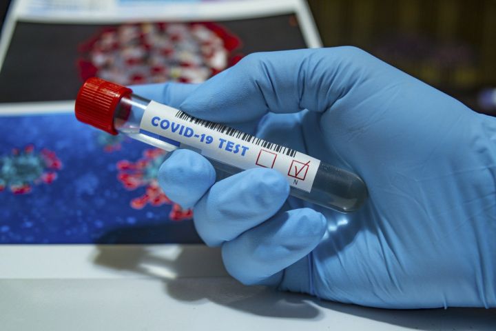 Azərbaycanda koronavirus ilə bağlı son vəziyyət açıqlandı