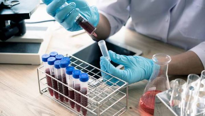 Azərbaycanda koronavirus ilə bağlı son vəziyyət açıqlandı