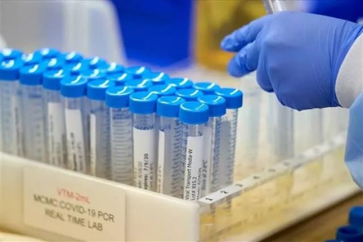 Azərbaycanda koronavirus ilə bağlı son vəziyyət açıqlandı