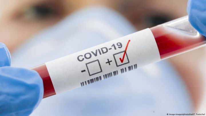 Azərbaycanda koronavirus ilə bağlı son vəziyyət açıqlandı